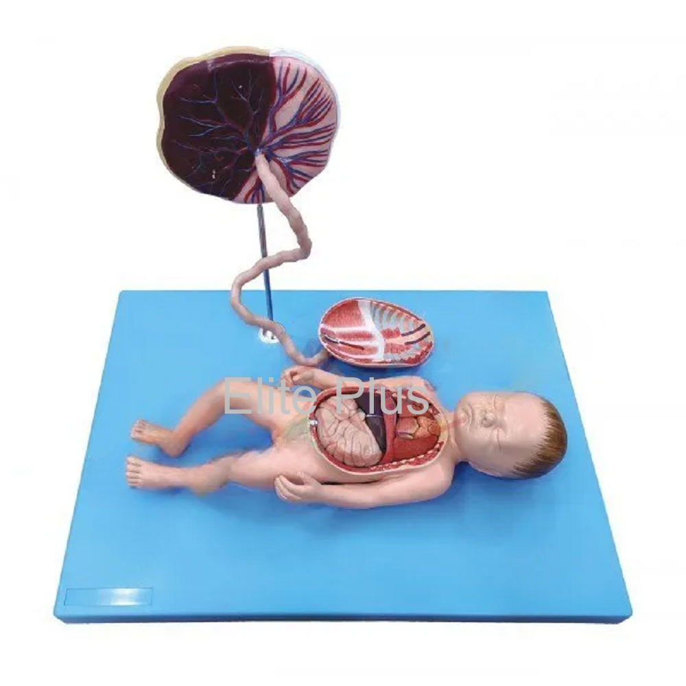 Full Term Fetus with Viscera and Placenta