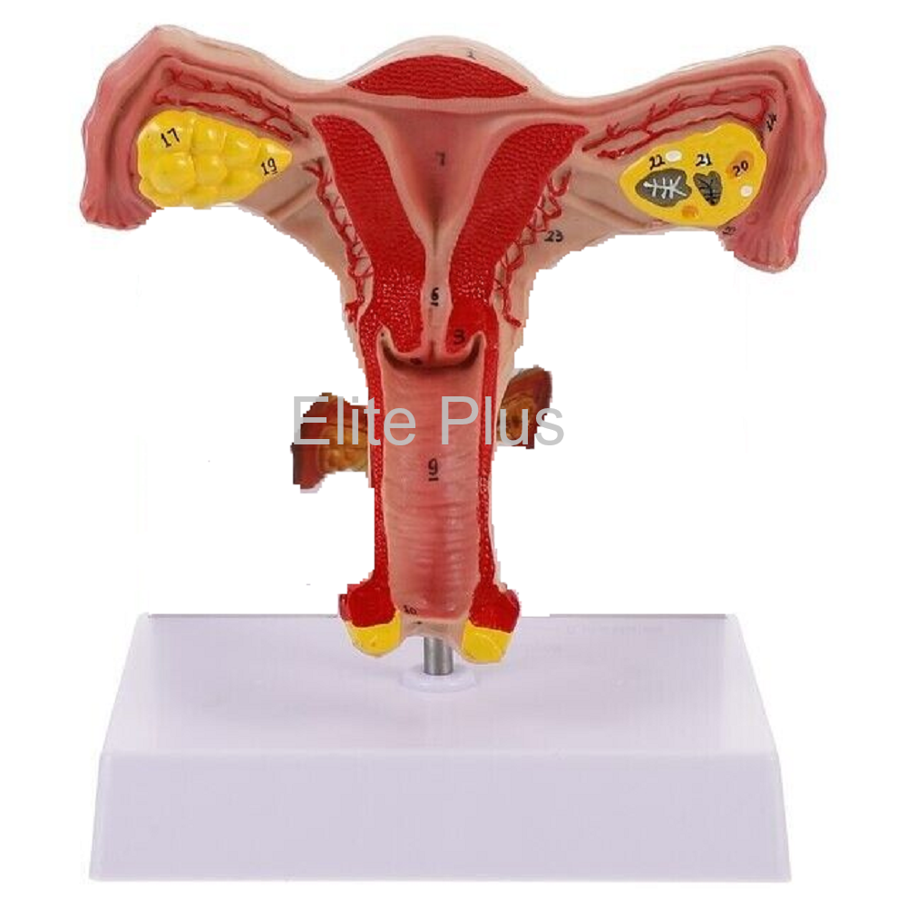 Female Uterus Ovary Model