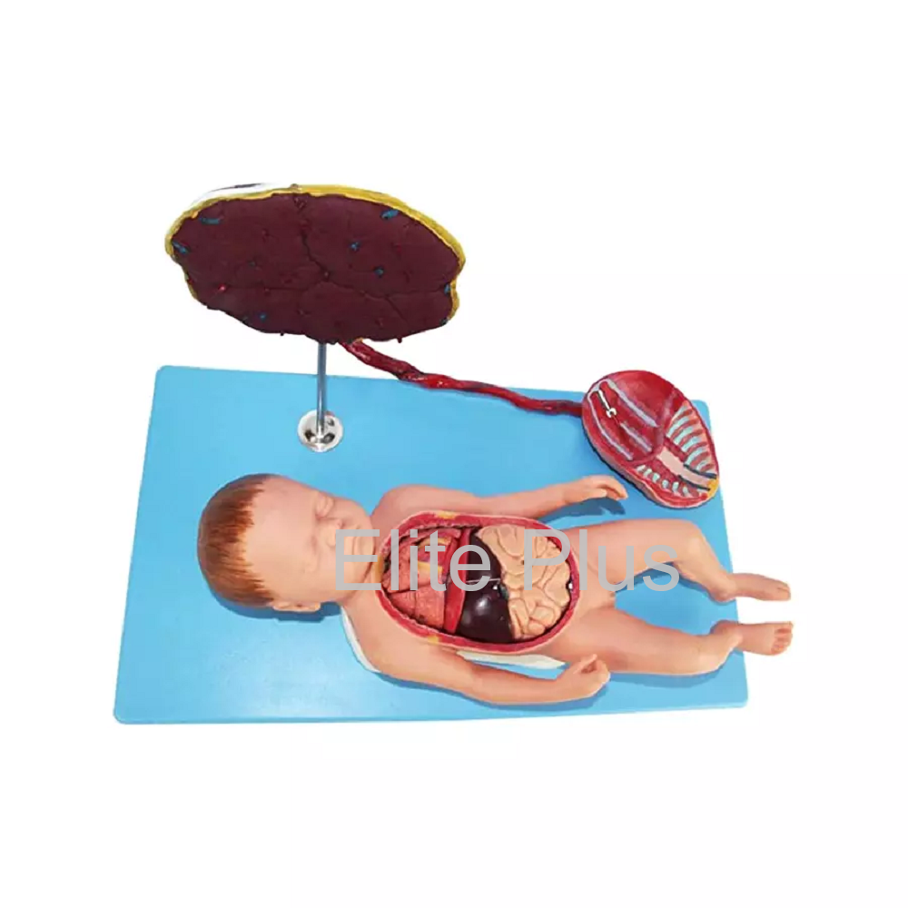 GD/A42008 Fetus with Viscus and Placenta