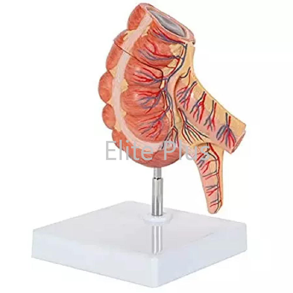 ZX-1434P Caecum and Appendix, Enlarged