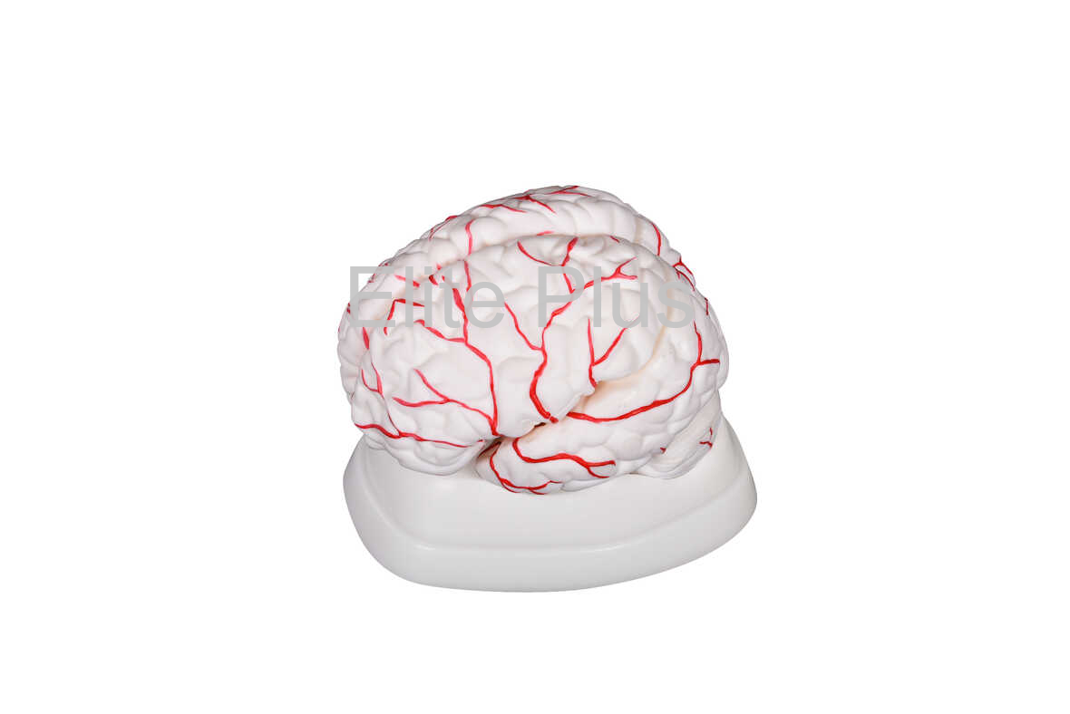 XC-308 Brain with Arteries