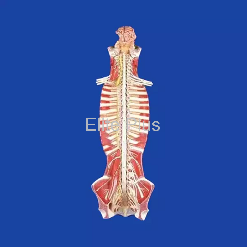 GD/A18102 Spinal Cord in the Spinal Canal