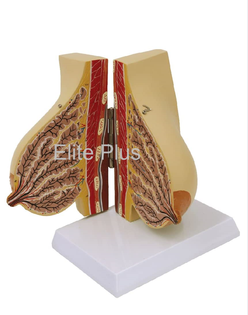 Female Breast Model Dx. During Lactation
