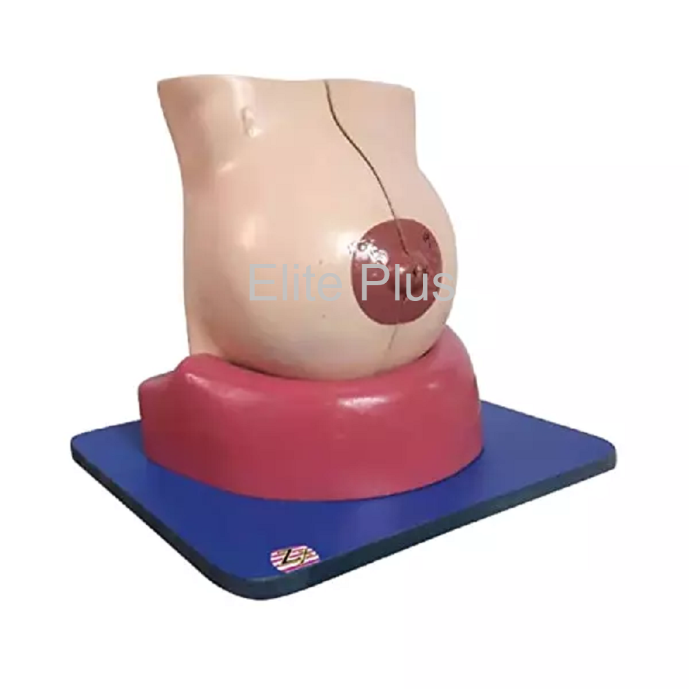 Female Breast Model