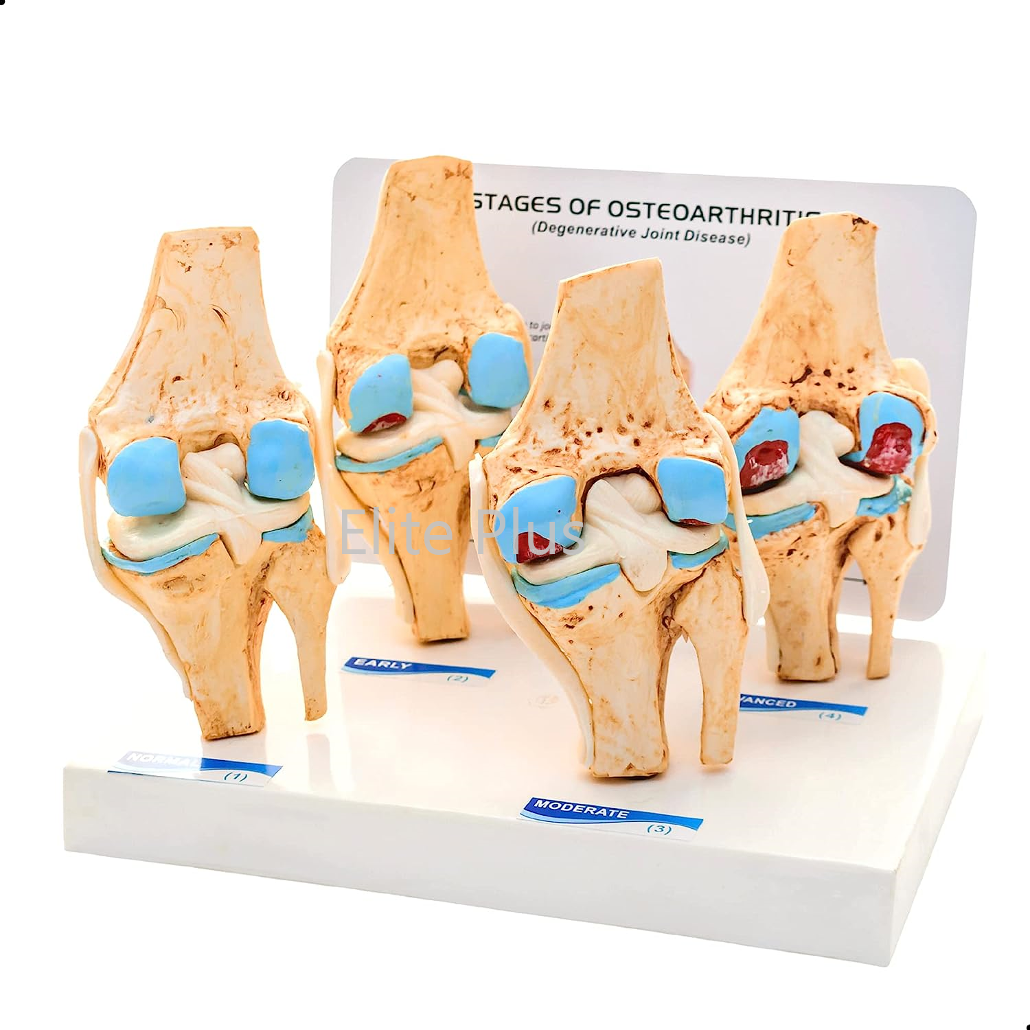 ZX-1510P Knee Arthritis Model