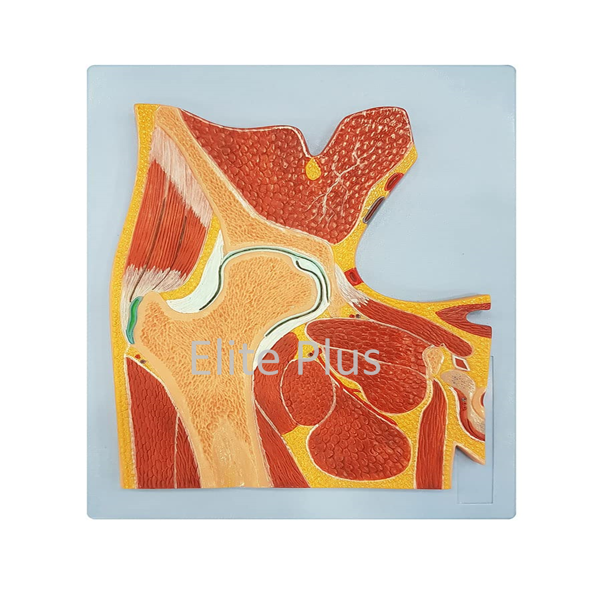 ZX-1215P Hip joint Section Model
