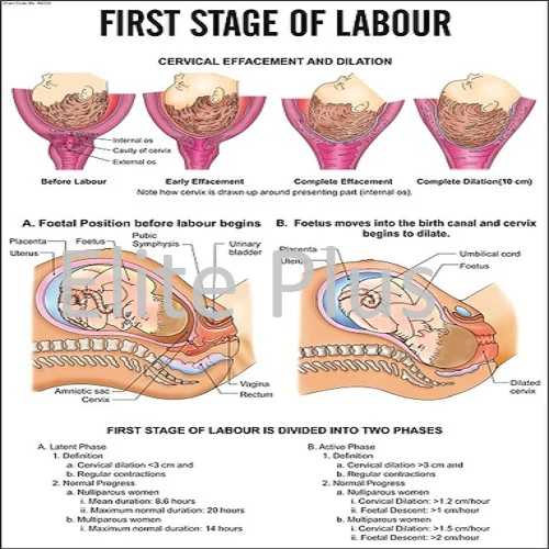 First Stage of labour