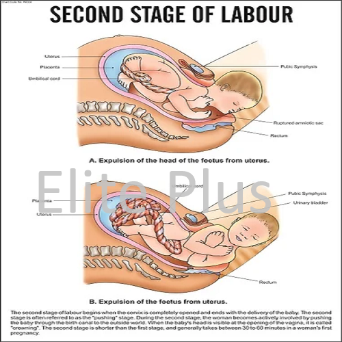 Second Stage of labour