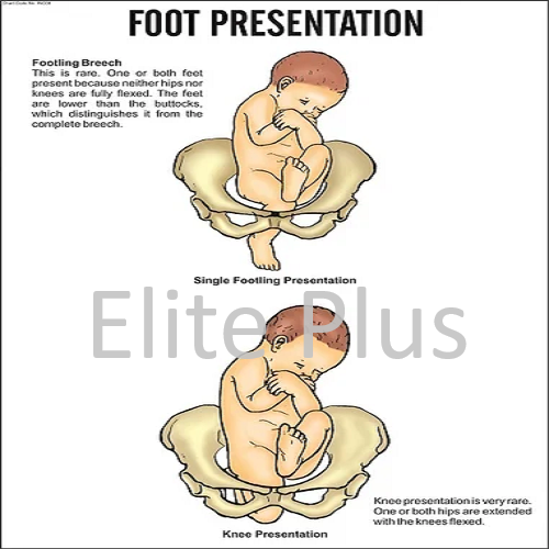 Foot Presentation
