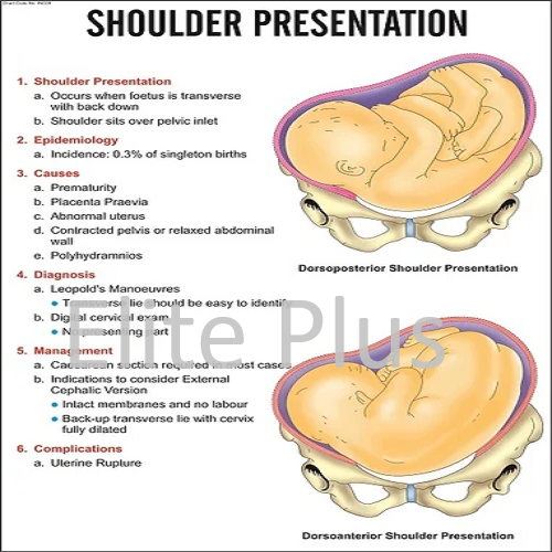 INC09 Shoulder Presentation