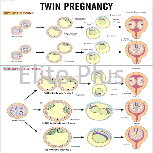 Twin Pregnancy