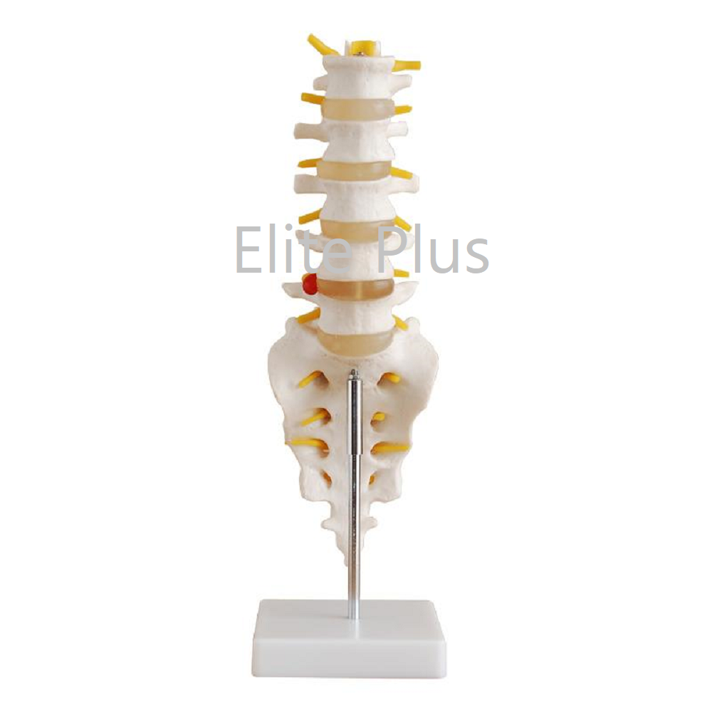 XC-119 Life-Size Lumbar Vertebrae with Sacrum & Coccyx and Herniated Disc (Copy)