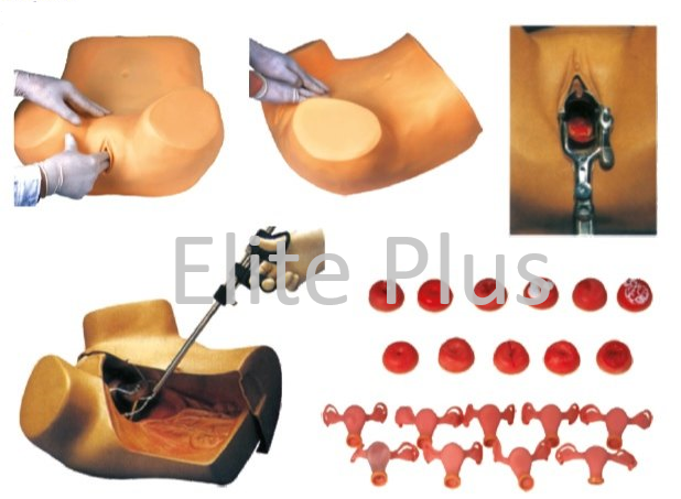 Gynecological Examination Model