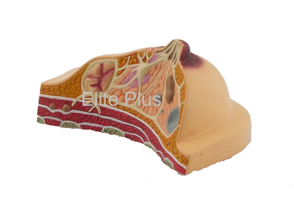 Breast Pathologies Model